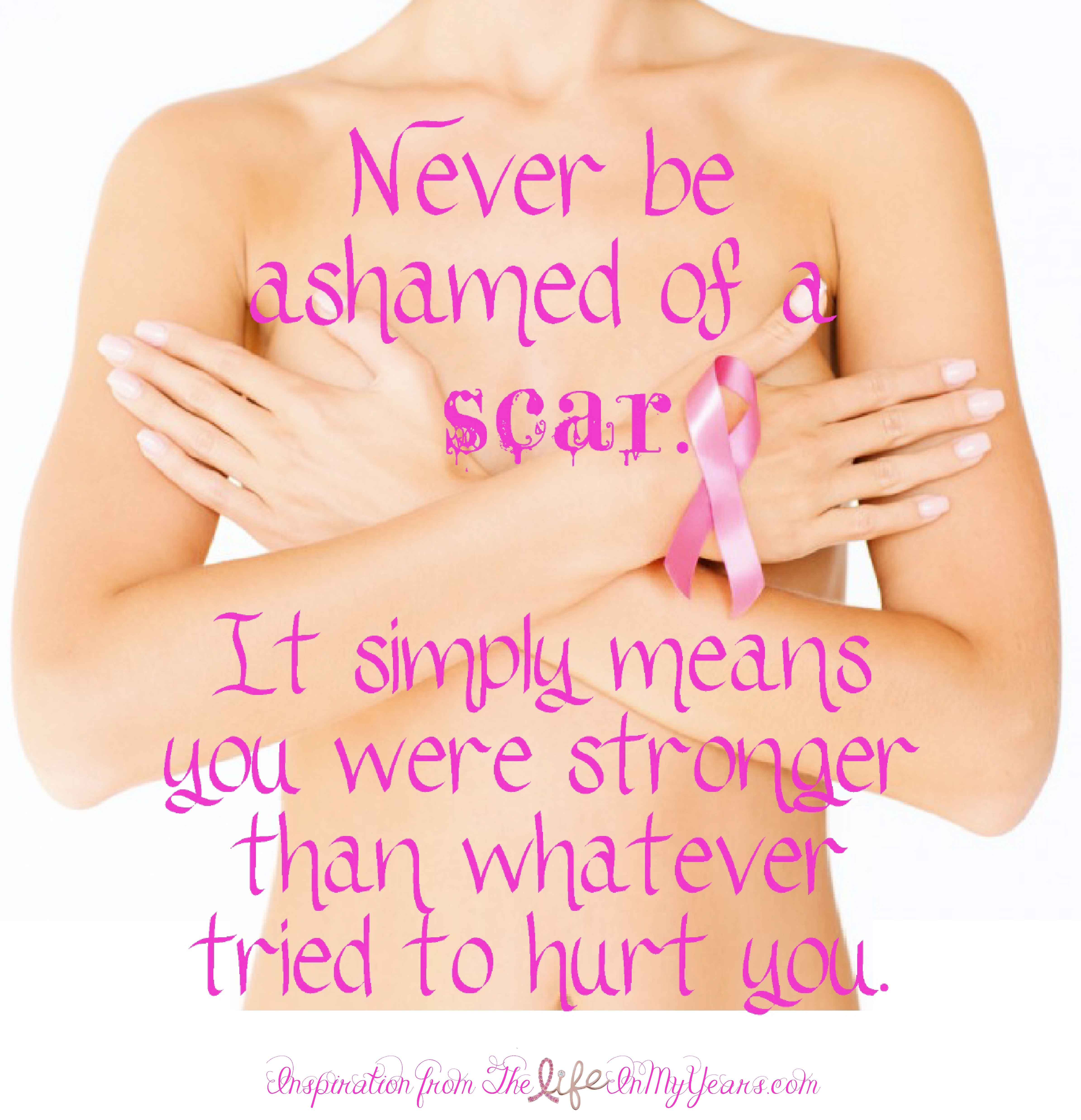 Breast Cancer Scars - Never be ashamed of a scar. It simply means you were stronger than whatever tried to hurt you.